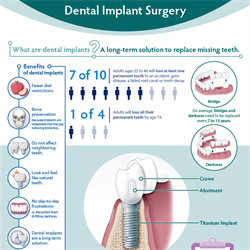 Dental Implant Surgery Infographic (PDF)