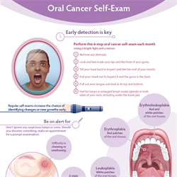 Oral Cancer Self-Exam Infographic (PDF)